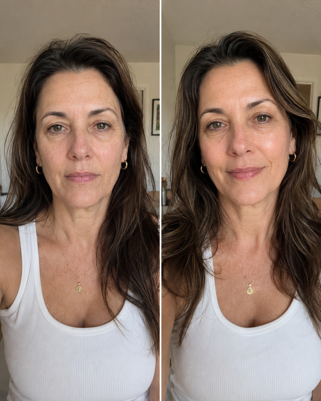 Prima / Dopo — drenaggio viso cosmetico
