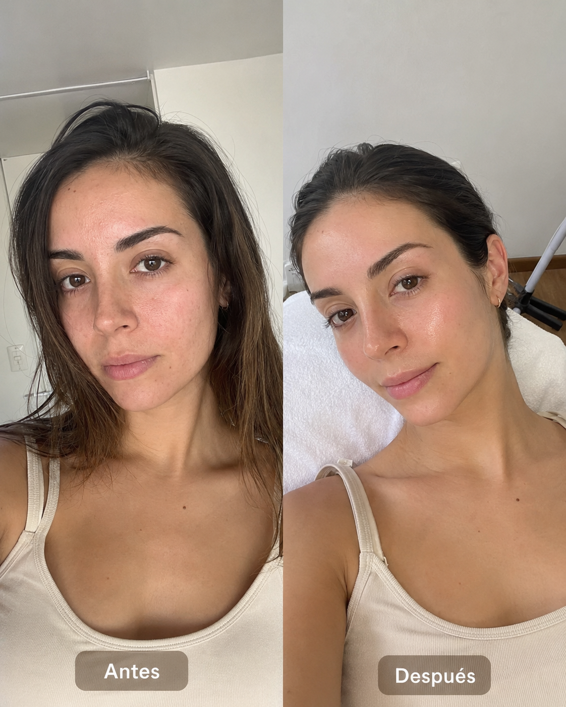 Prima / Dopo — drenaggio viso cosmetico