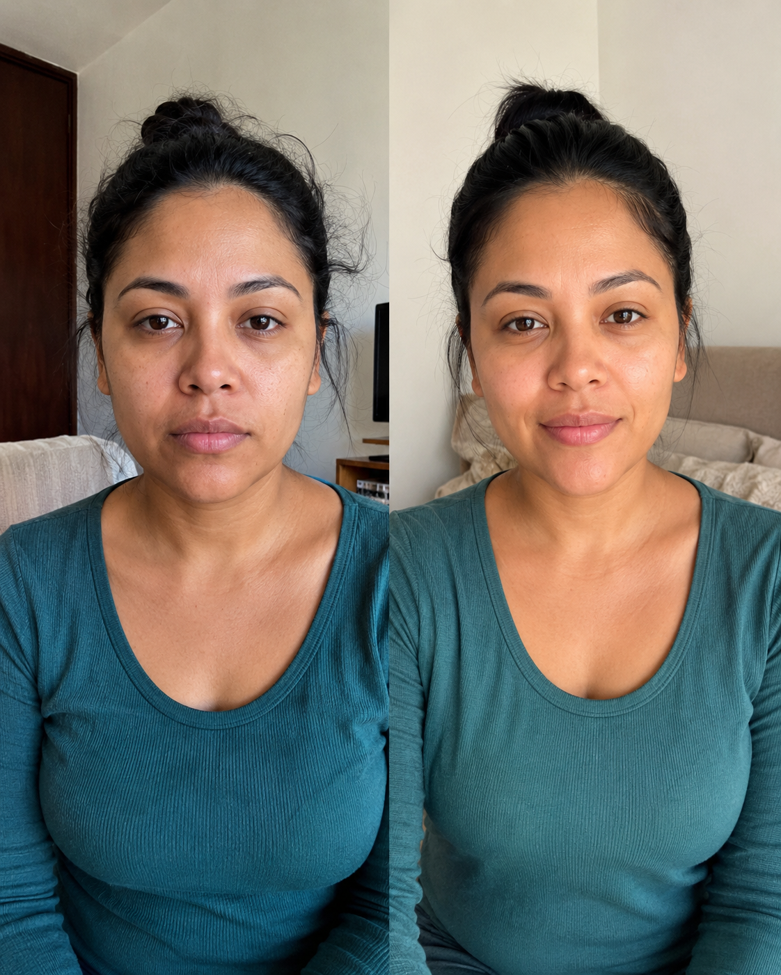 Prima / Dopo — drenaggio viso cosmetico